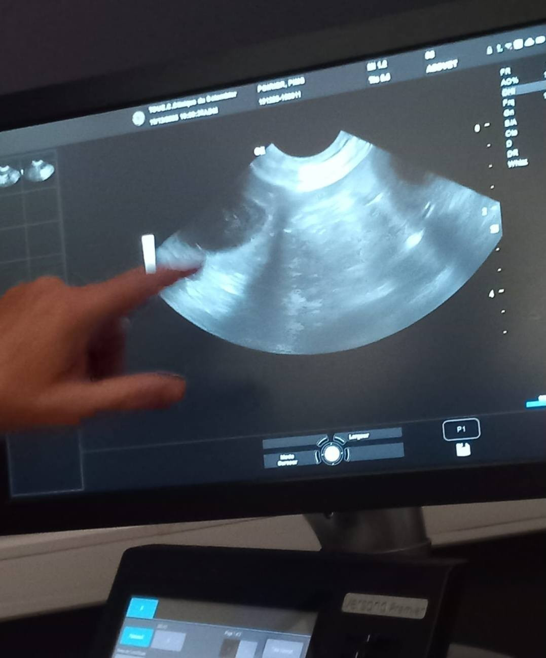 Notre Princesse Pim's attend bien des bébés !